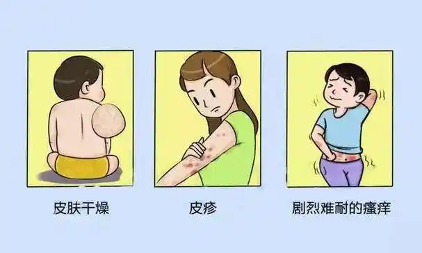 警惕:这些原因容易导致"接触性皮炎"的发生,共勉|过敏|虫咬皮炎|炎症