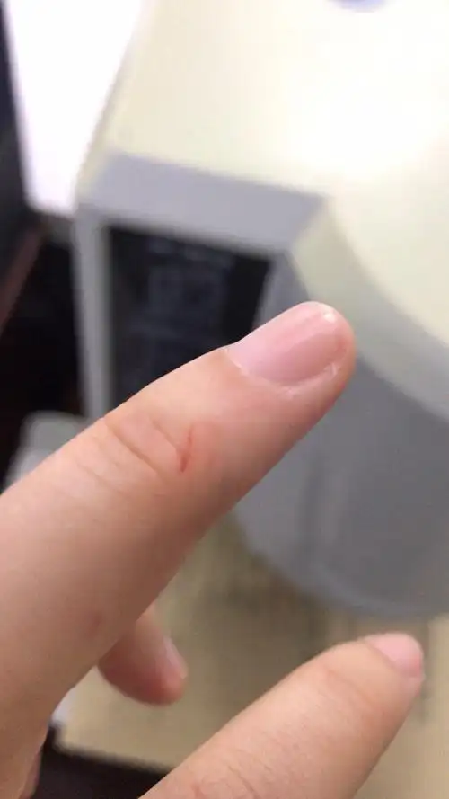 手指被纸张割破了