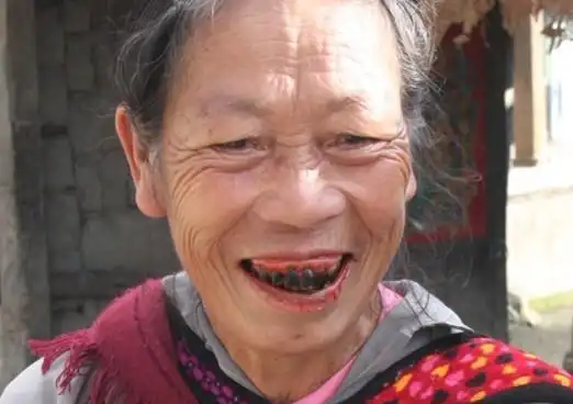 一组嚼槟榔的恐怖照片血盆大口好吓人