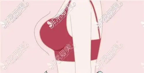 6种胸型是哪6种看完六大胸型图案特点分析就清楚