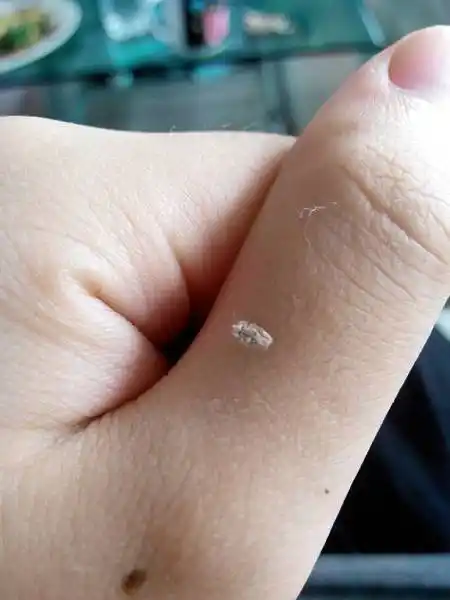 看手上的小昆虫,它叫啥名?