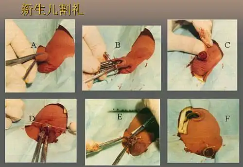 女性割礼图片图片 女性割礼图片照片 女性割礼图片写真