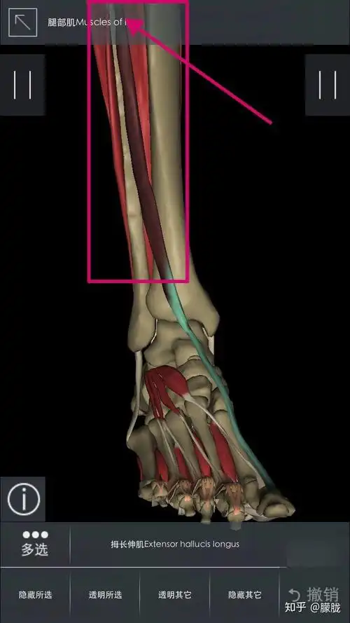 脚背(拇长伸肌)疼是什么原因,怎么办? - 知乎