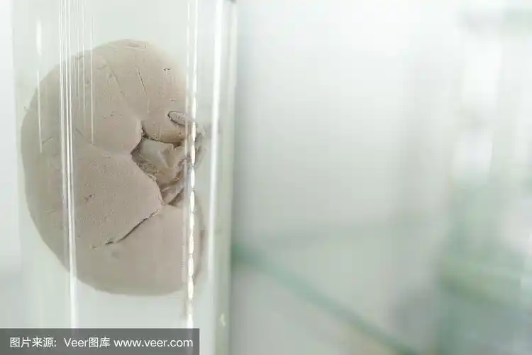 人体器官解剖学.人的肾部分在福尔马林中.医学科学技术