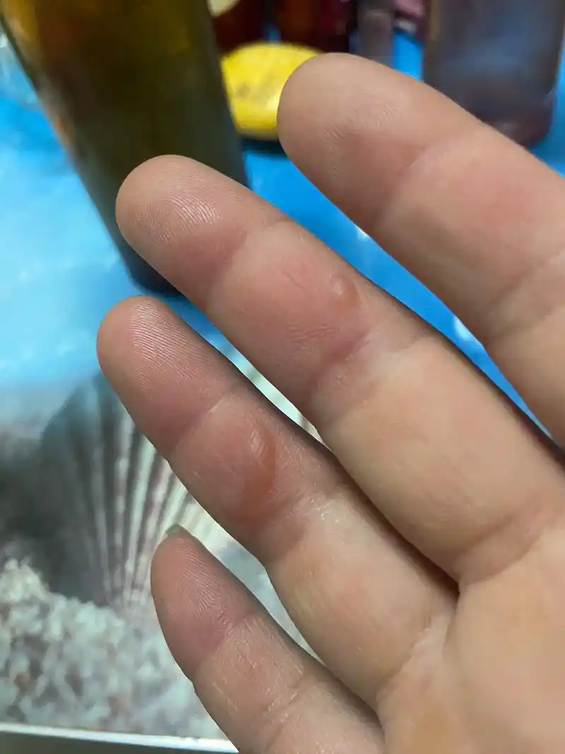 今天搬砖,手磨了两个水泡#干活的手 #始于心甘情愿终于愿赌服 - 抖音