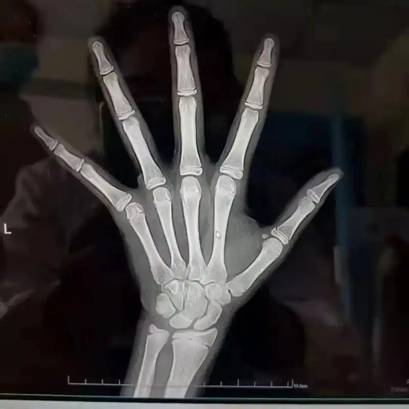 5公分!昨天简单发了一下,很多家长都问孩子具体 - 抖音