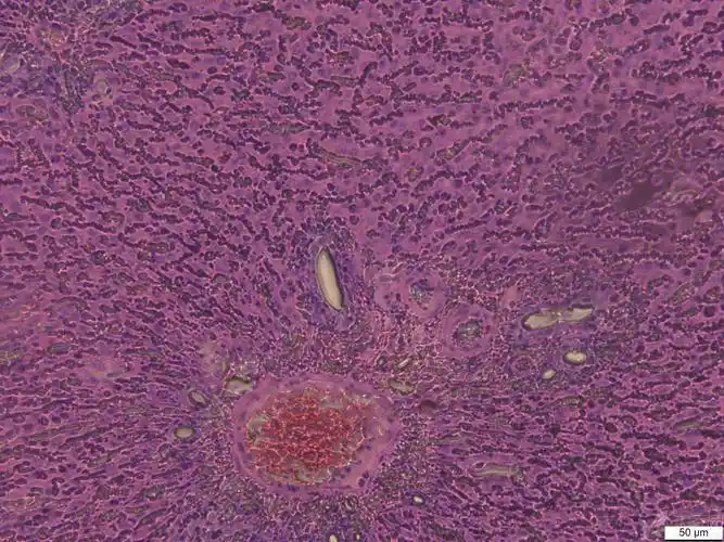谁能帮我看几张肝脏的病理组织切片