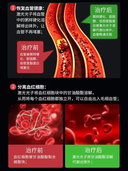 光盾表式半导体生命激光治疗仪降三高糖尿病高血压血氧理疗器马宁