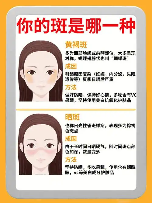 斑点类型75教你怎么解决