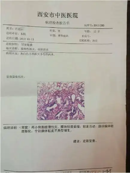 疗前病理报告疗后病理为"胃窦浅表粘膜慢性炎"患者4:许建*:疗前病理