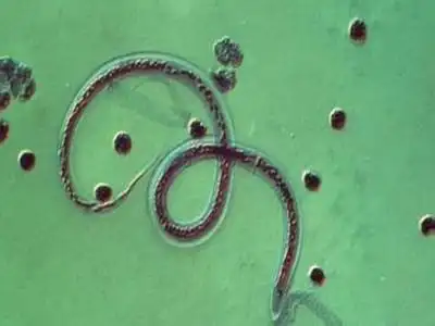 学生如何避免蛲虫病的发生