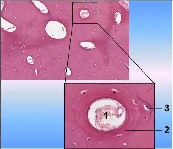 长骨骨干密质骨光镜像,图中2指示的是何种结构?()