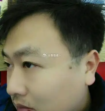 鬓角有痣代表什么鬓角左边有痣,则代表着他的家庭关系和生活状态,说明
