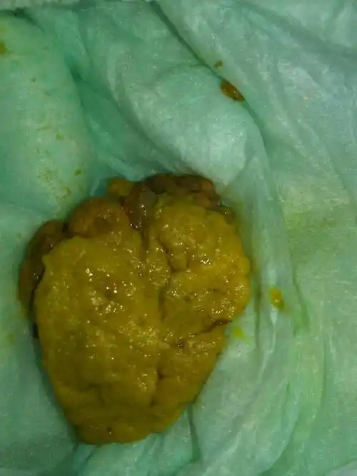 宝宝七个月,一天拉大便三次,但是是放屁拉出来的大便.请问是拉肚子吗