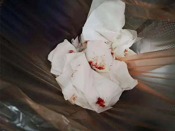 卫生纸上已经干了的血迹能做亲子鉴定吗