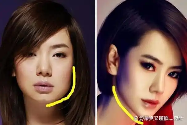 颜值不够后天弥补这7位明星有人换头成功有人却不人不鬼