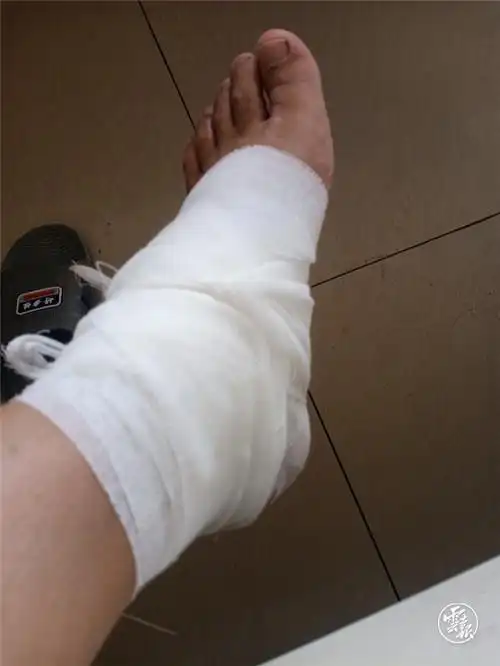 大理辅警被地震落石砸伤脚踝咬牙坚守疏导保通一线