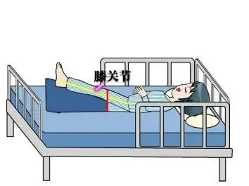 科普工作委员会胫骨平台骨折术后该如何正确康复