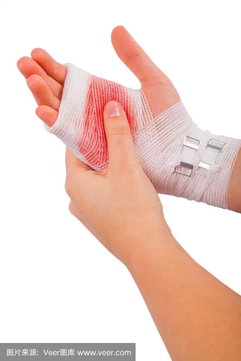 女孩受伤的手被白色绷带绑着