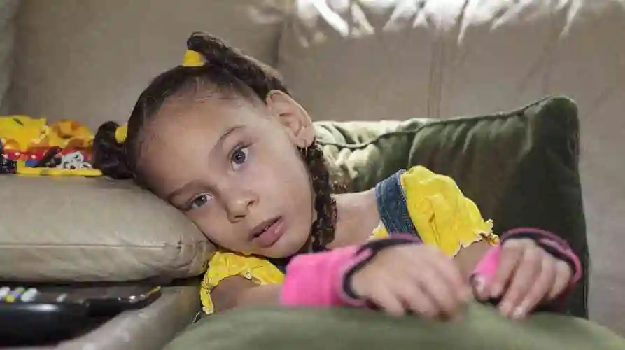 二个月脑瘫婴儿从图片上看是什么样子的