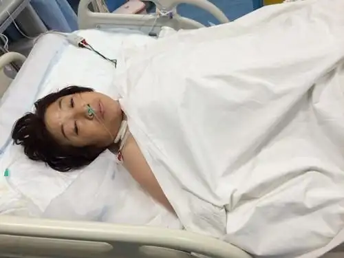 罕见b型rh阴性血病人车祸截肢 请伸出援助之手