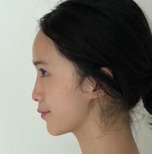 塌鼻梁侧脸侧脸照片侧脸图挺鼻梁和塌鼻梁对比塌鼻梁侧脸图亚洲人侧脸