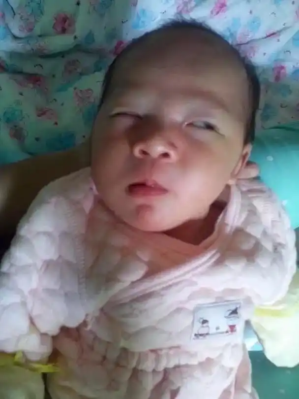 因为是顺产,刚生下来脑袋尖尖的,脸上还有白点点,真的丑到我了
