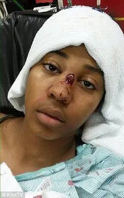 美女子在家遭枪击大难不死 眼镜框弹开子弹