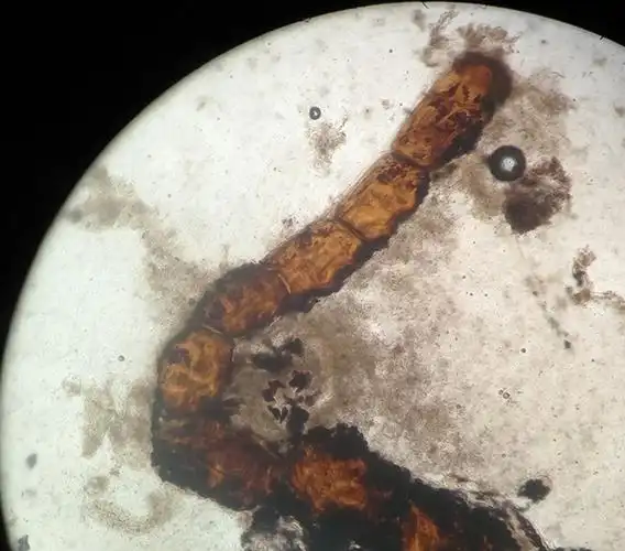 爱缠狗狗的绦虫,更让主人烦透了,到底该怎么防这种寄生虫?