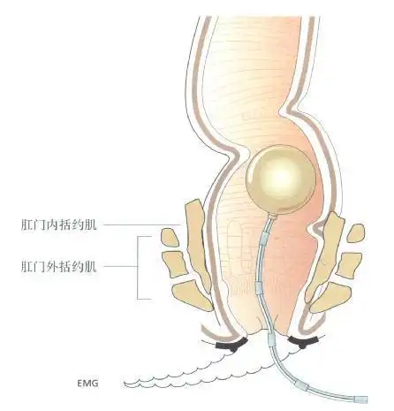 直肠肛门内胀痛不适