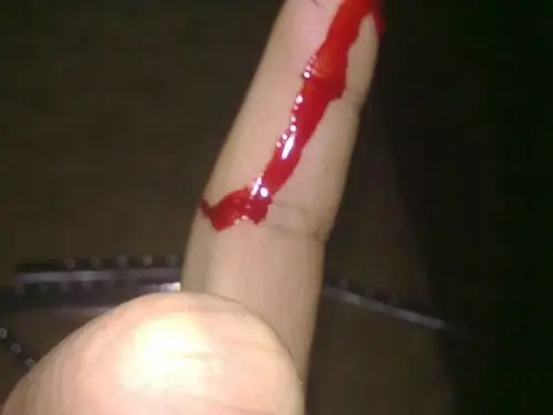 手指流血图片52