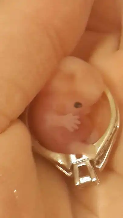 她两次不幸流产为纪念未出生就夭折孩子她的举动让人感动