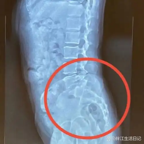 认识一块非常重要的骨骼:骶骨