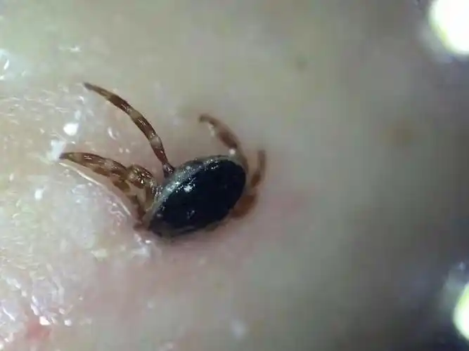 一个生活在普通城市里的人感染寄生虫的概率是多大?