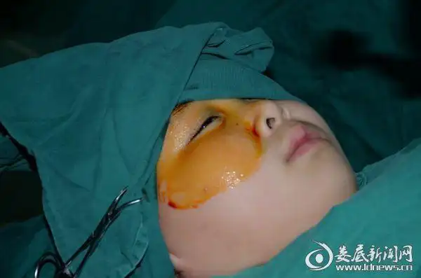 术前消毒 准备手术