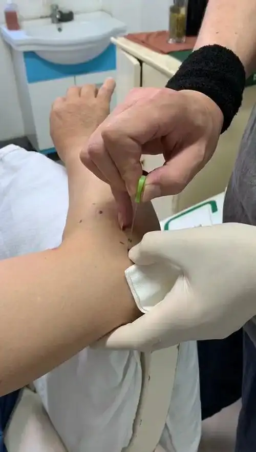 针刀治疗网球肘