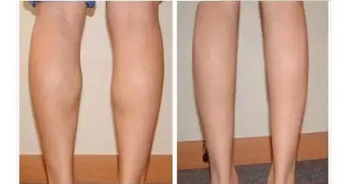 两者区别对比来了!