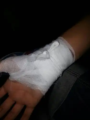 手把手教你包扎