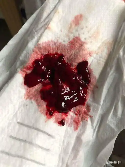 月经,例假你们来的时候只是血吗?因为我有时候有血块?