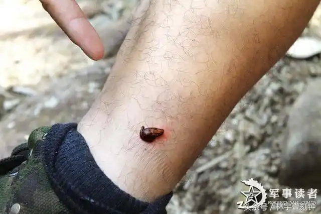 蝎子蜇人,毒液即由此流入伤口.