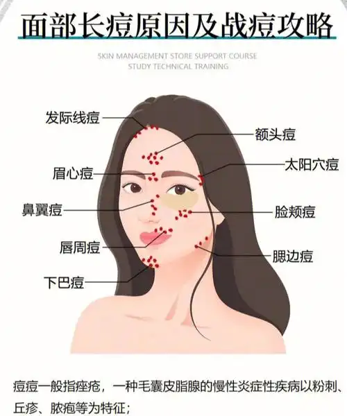 也有可能你的身体内有些小麻烦哦~今天,跟姐姐一起了解下脸部各个部位