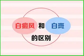白斑是不是就是白癜风