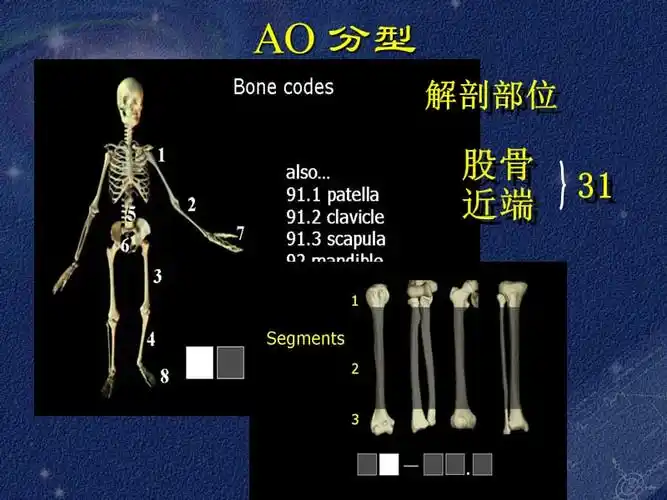 股骨转子间骨折的治疗ppt