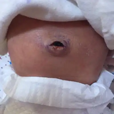 宝宝脐带掉了,但是衣服上会有血,涂紫药水可以吗