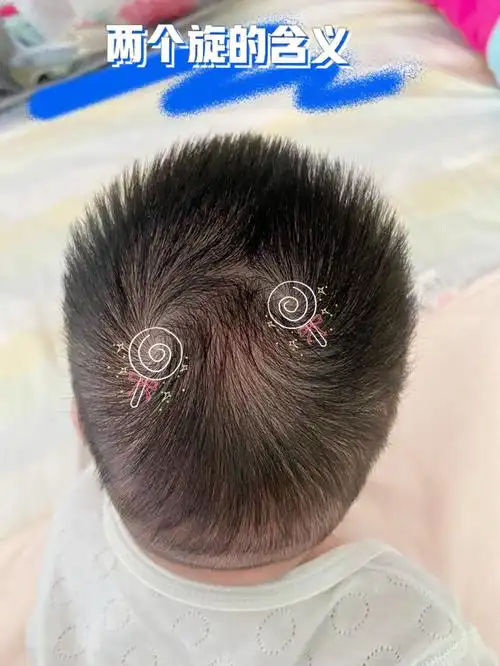大家的宝宝头上都有几个旋