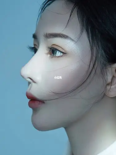 肋骨鼻术后第一效果 妈生鼻