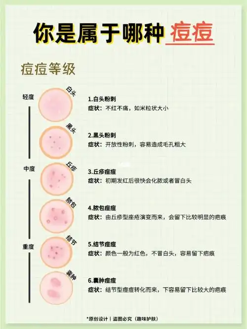 其实祛痘真的不能乱操作,要知道痘痘(痤疮)的类型很复杂,有粉刺,丘疹