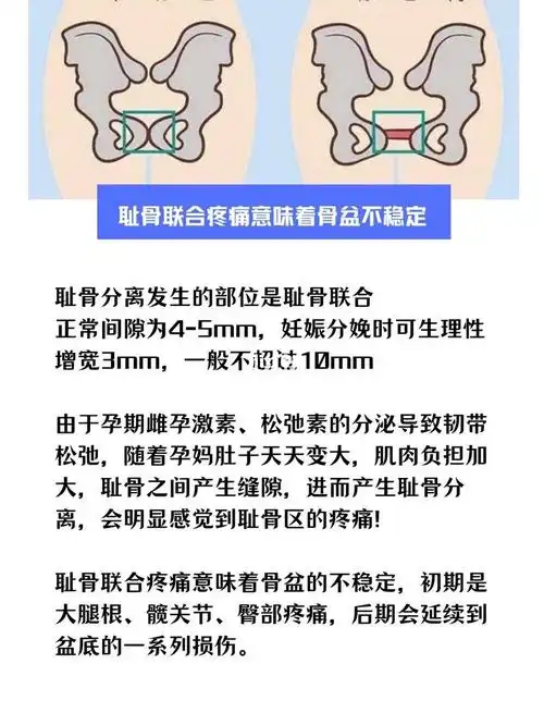 97你知道耻骨疼痛的隐患吗?