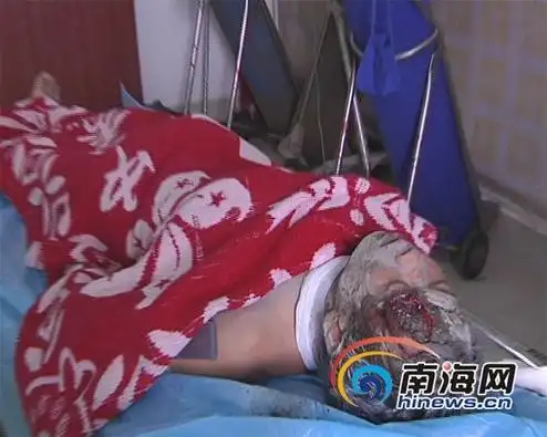 陵水海韵工地出事故3人被砸伤项目方曾封锁消息