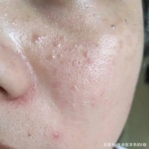 那你知道闭口是什么吗